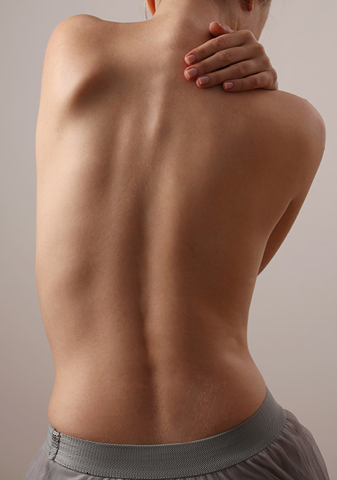 Woman with scoliosis